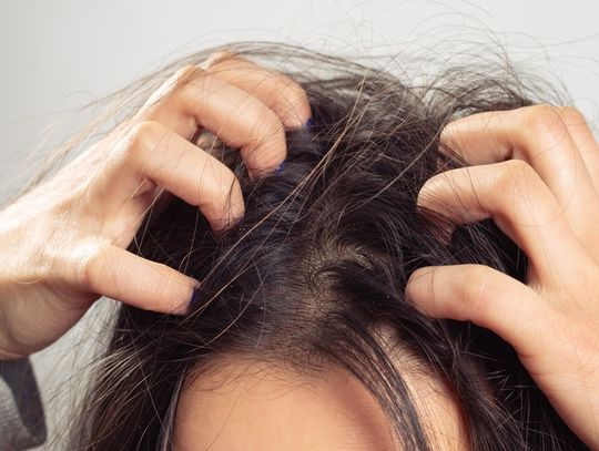 A person using both hands to scratch dark hair near the scalp, with loose strands against a light background.