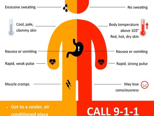 Heat Safety: Know the Signs