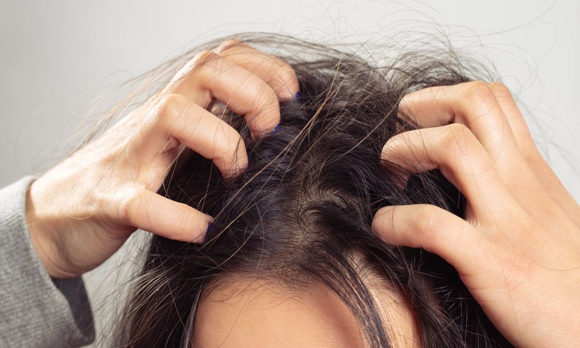 A person using both hands to scratch dark hair near the scalp, with loose strands against a light background.